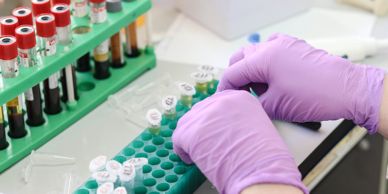 十年長青！博大博聚JSY型全自動細胞計數儀：憑什么成科研人心中的細胞計數 “經典款”？